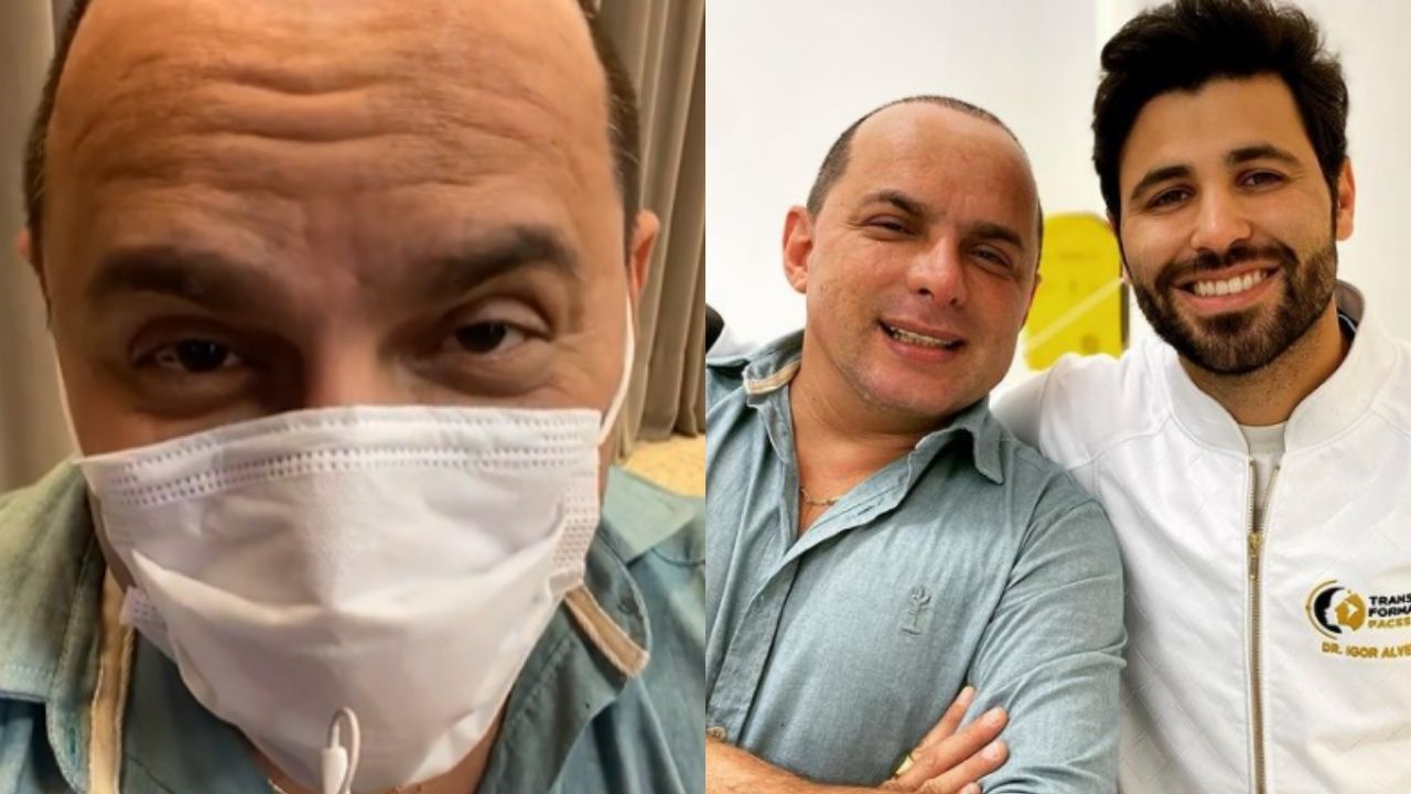 Seguindo a esposa, marido de Gretchen rebate críticas a procedimentos faciais: “Harmonização é uma oportunidade”