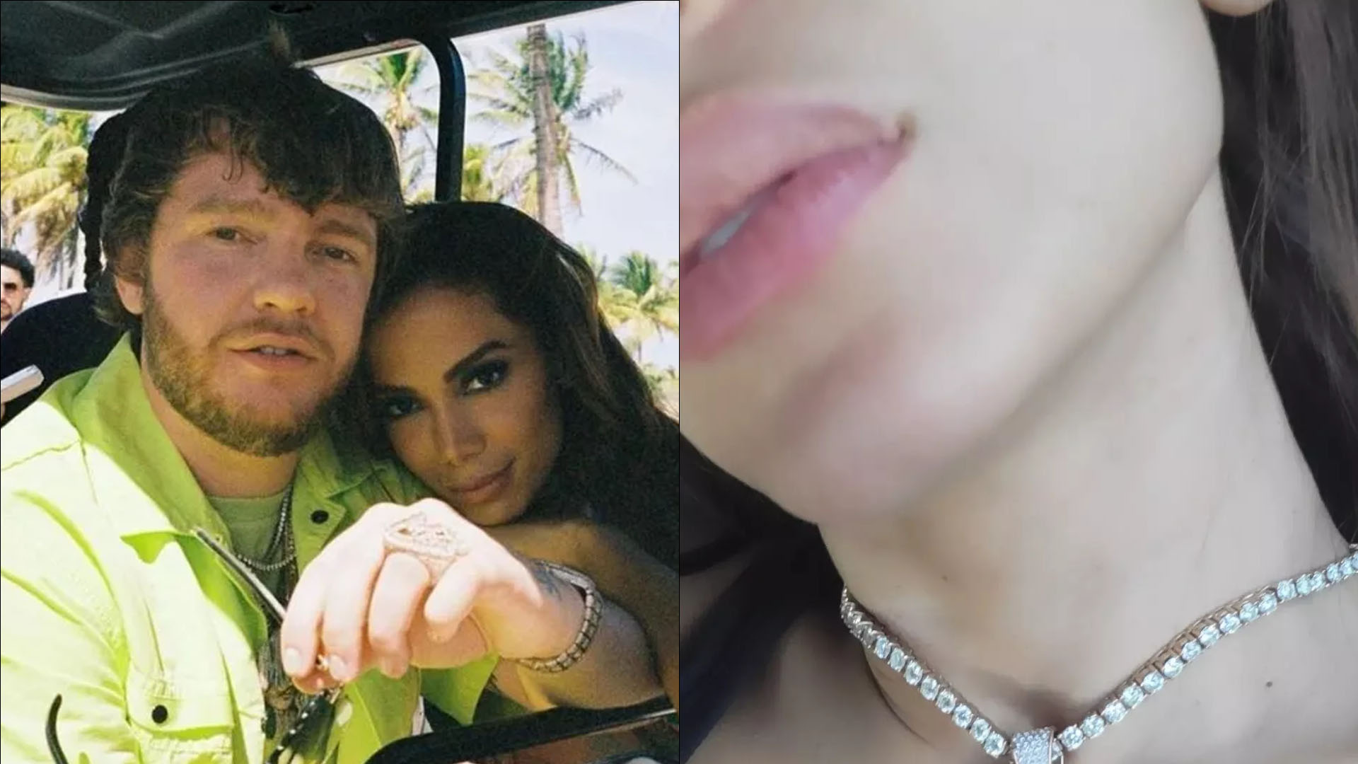 Virou moda? Anitta entra na onda e usa ‘coleira’ com nome do namorado Murda Beatz