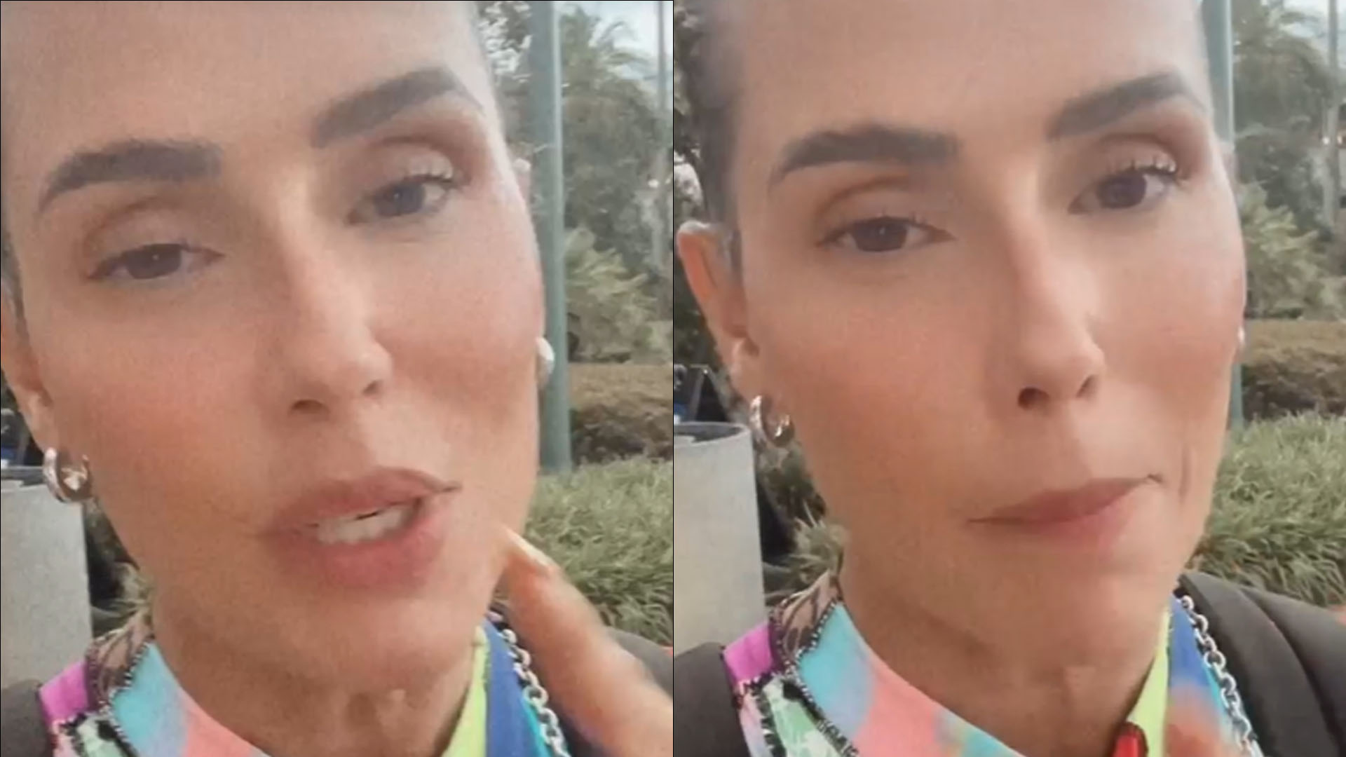 Deborah Secco faz procedimento no rosto e resultado é chocante: “Fiquei um alien”