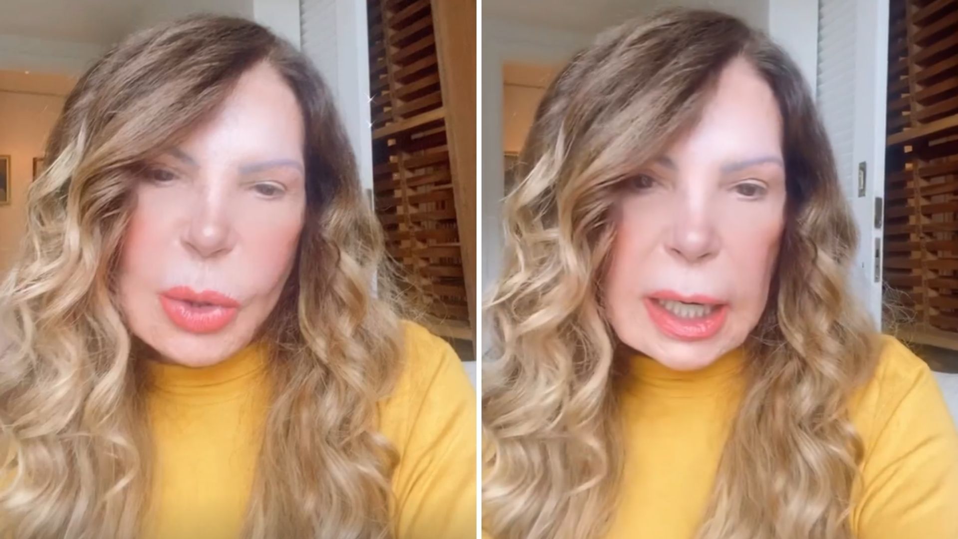 Elba Ramalho corta o silêncio após atropelar idoso de 71 anos: “Eu não tive culpa”