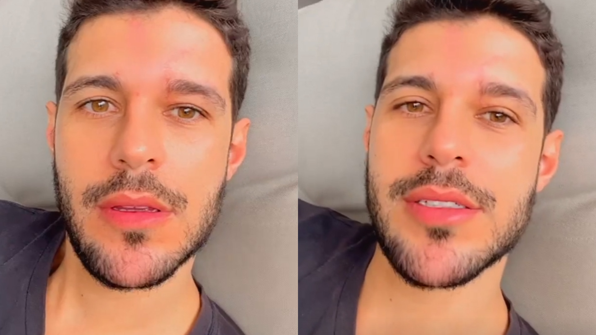 Ex-BBB Rodrigo Mussi revela resultado de exame importante: “No cérebro”