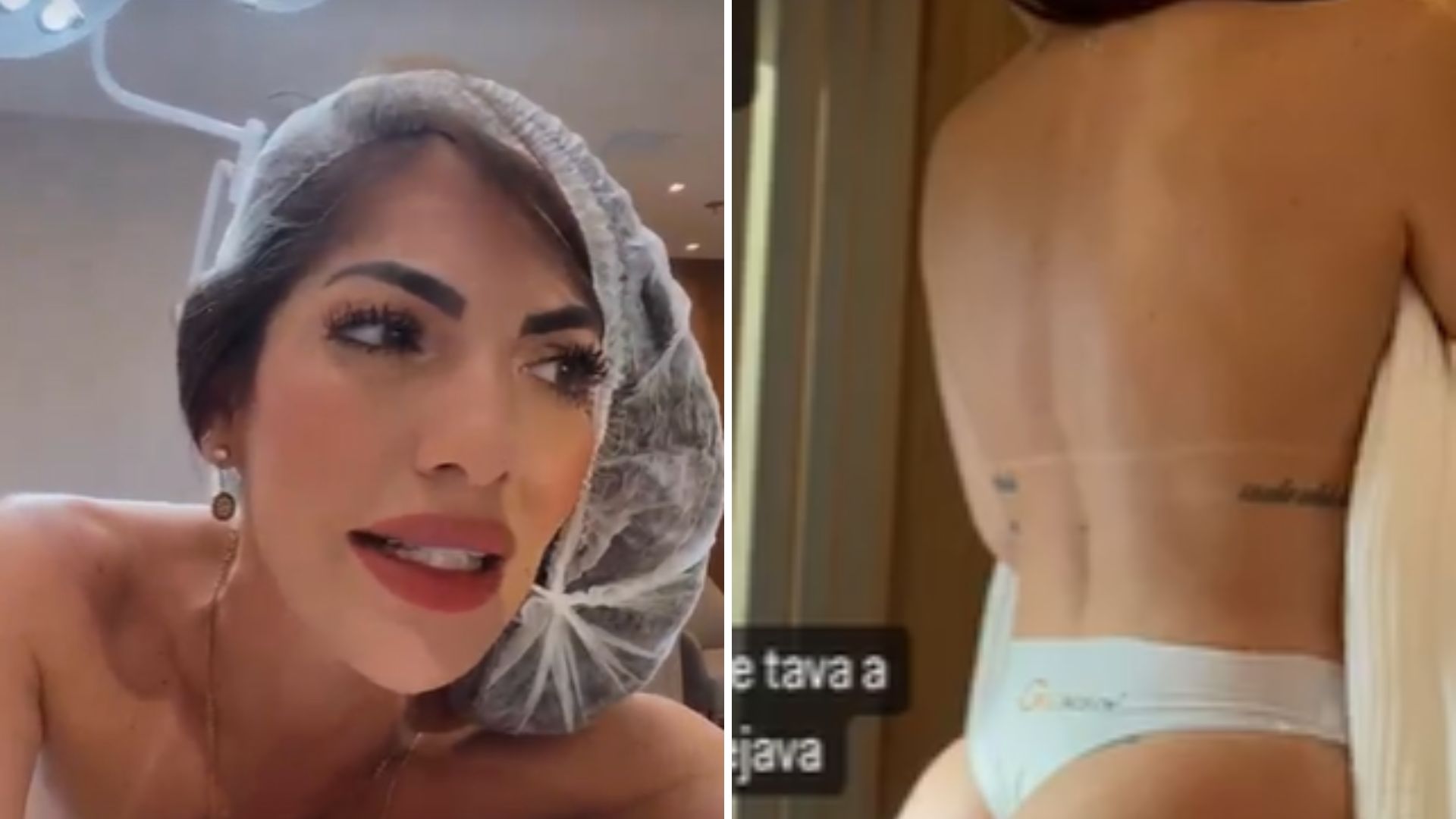 Ex-BBB Anamara recorre a procedimento estético para melhorar autoestima: “Um incômodo”