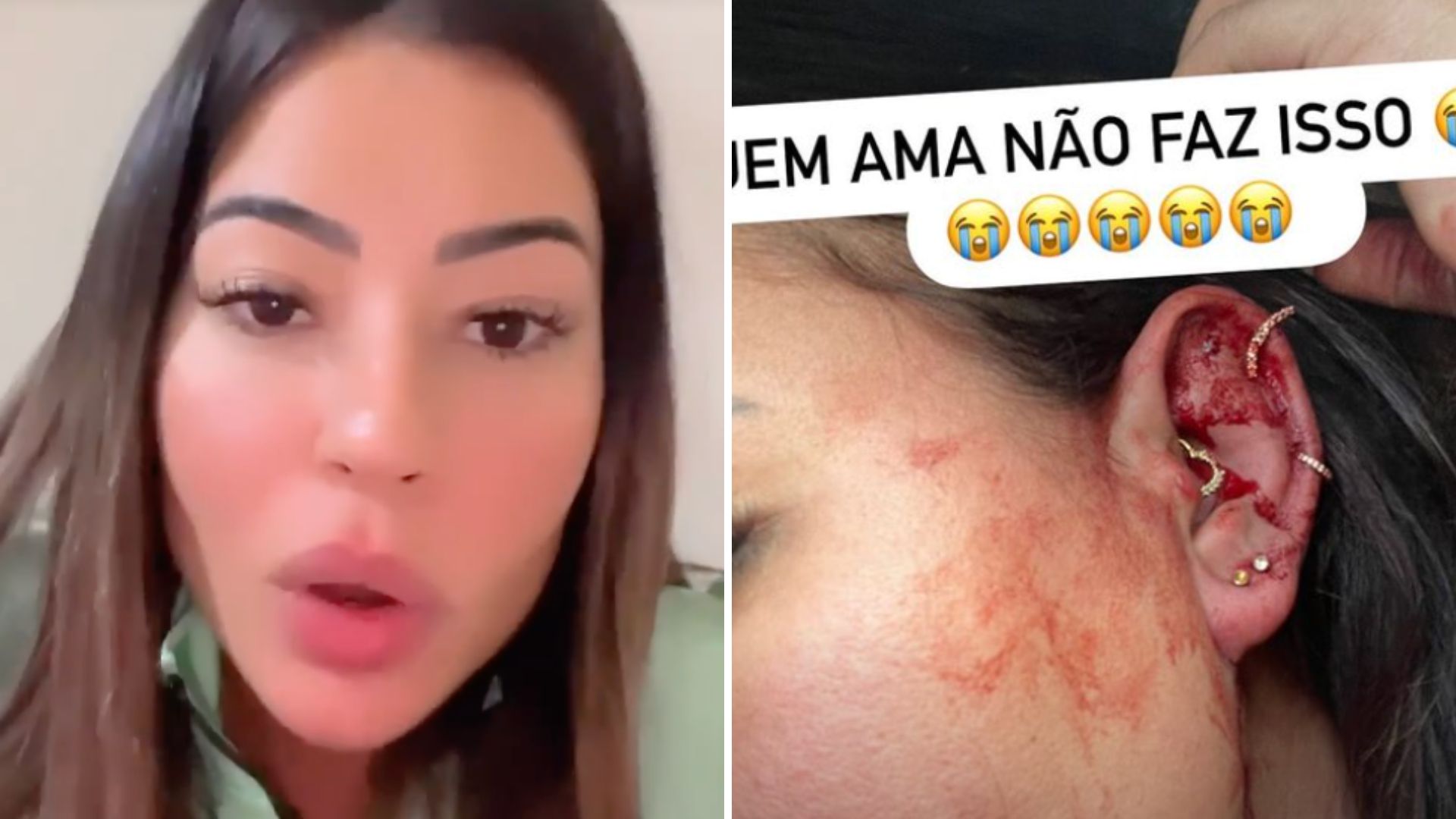 Influenciadora choca fãs ao aparecer ensanguentada após agressão: “Eu não mereço”