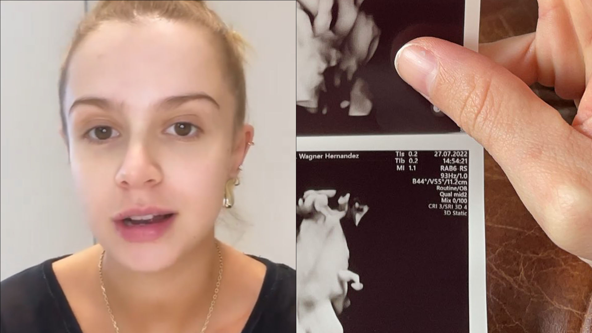 Na reta final, Isa Scherer mostra rostinhos dos gêmeos em ultrassom 3D: “Apareceu”