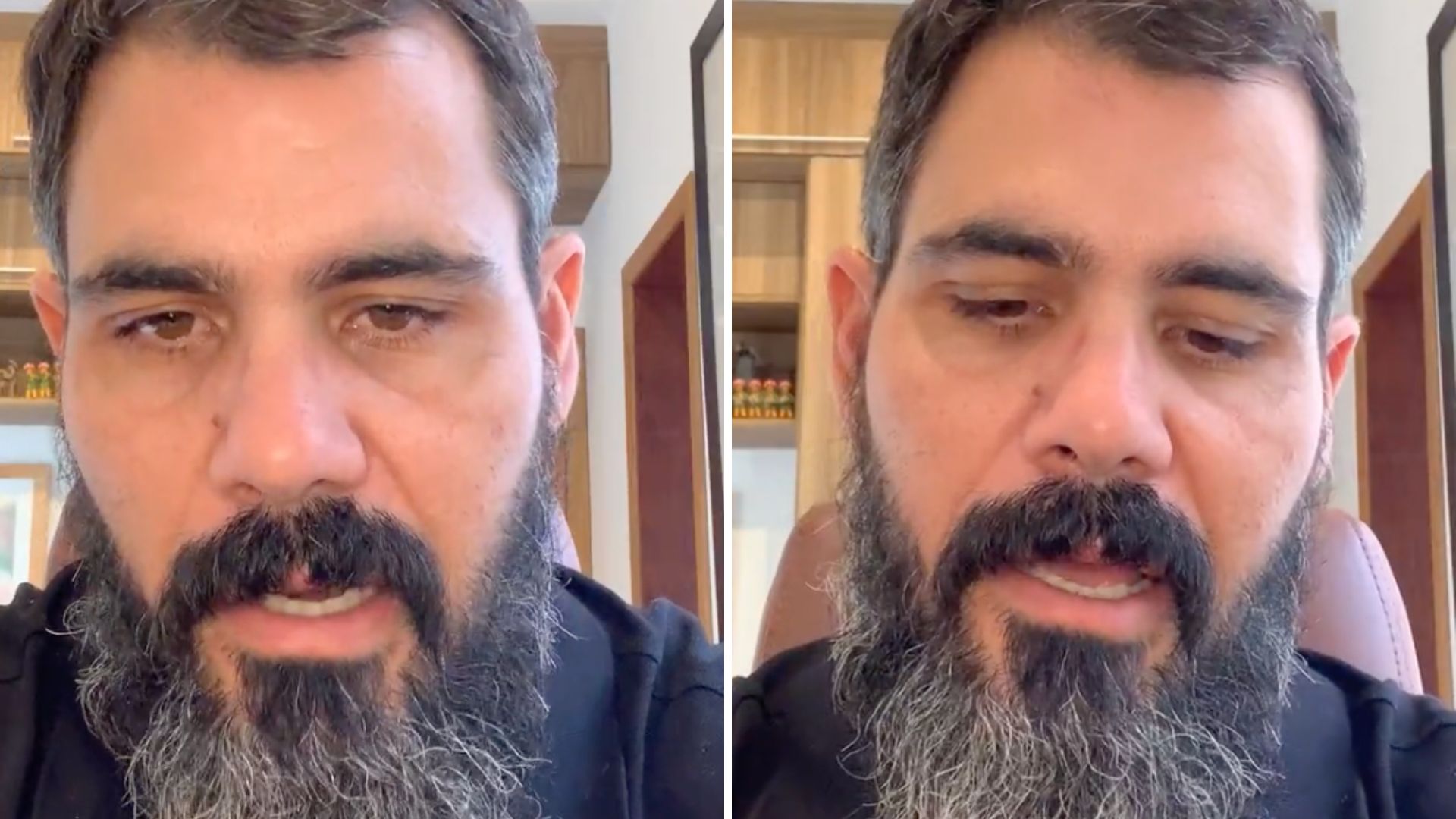 Vivendo drama, Juliano Cazarré surge abatido, chora e pede orações dos fãs: “Baita susto”