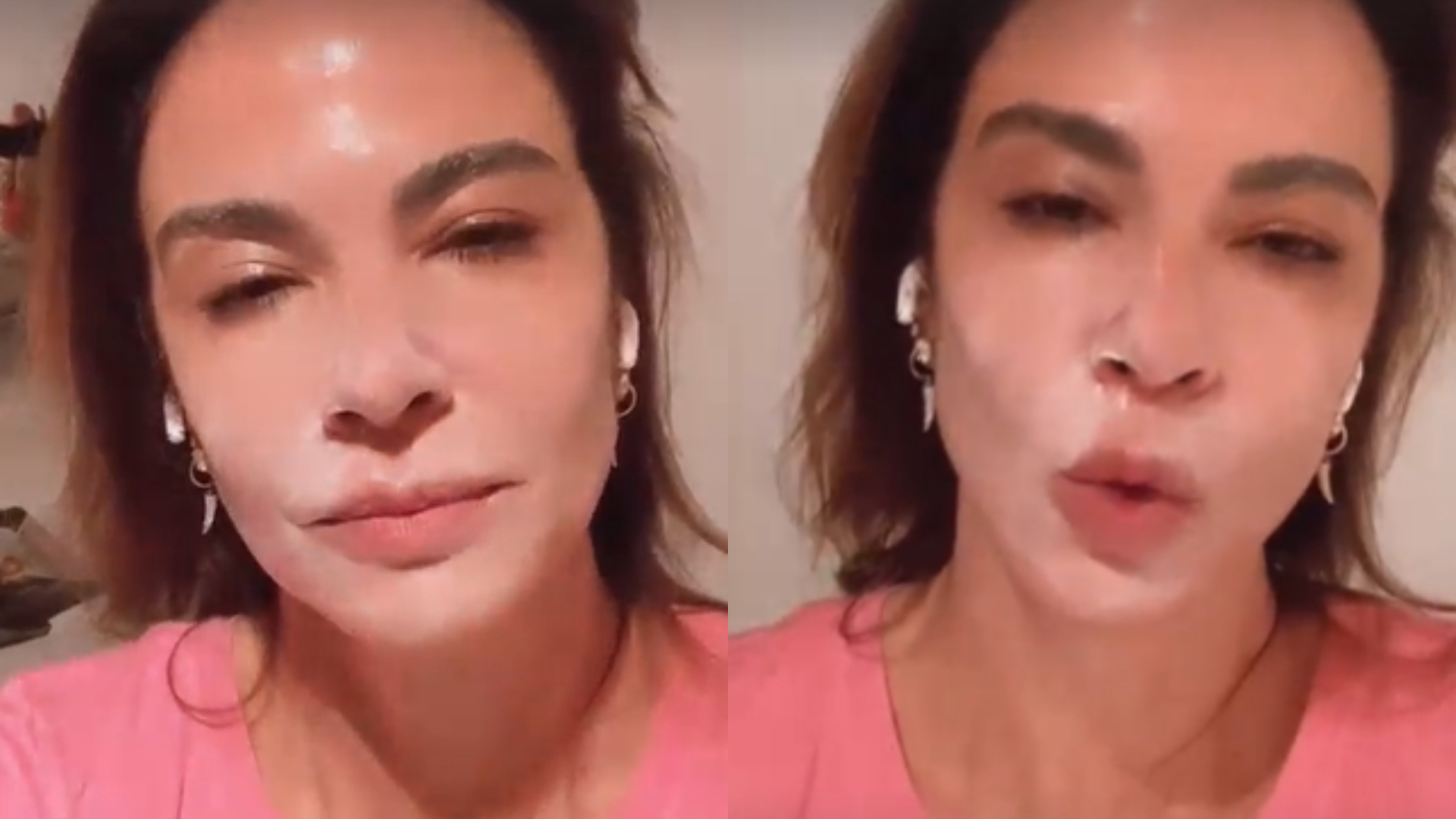 Luciana Gimenez surge com rosto coberto de pomada e desabafa: “Queimei total”