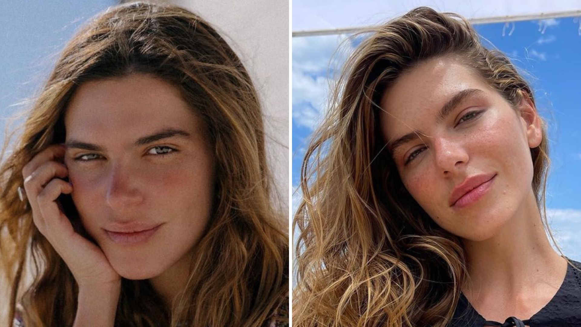 Mariana Goldfarb retira preenchimentos após viver pesadelo: “Não me reconhecia”