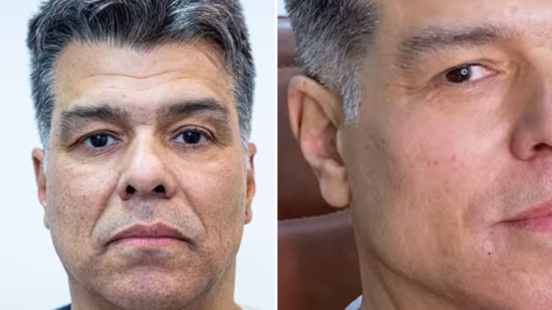 Outra pessoa? Maurício Mattar choca com resultado de harmonização facial: “Sem exageros”