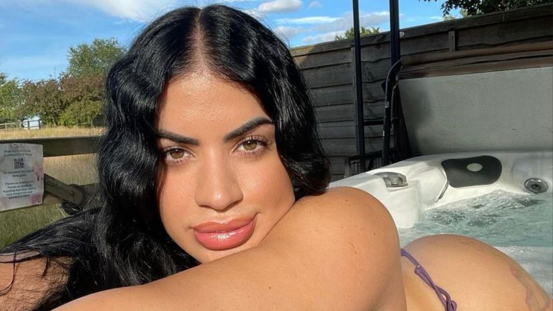 Modelo body positive quebra tabus e exibe celulites: “Recebo mais julgamentos de mulheres”