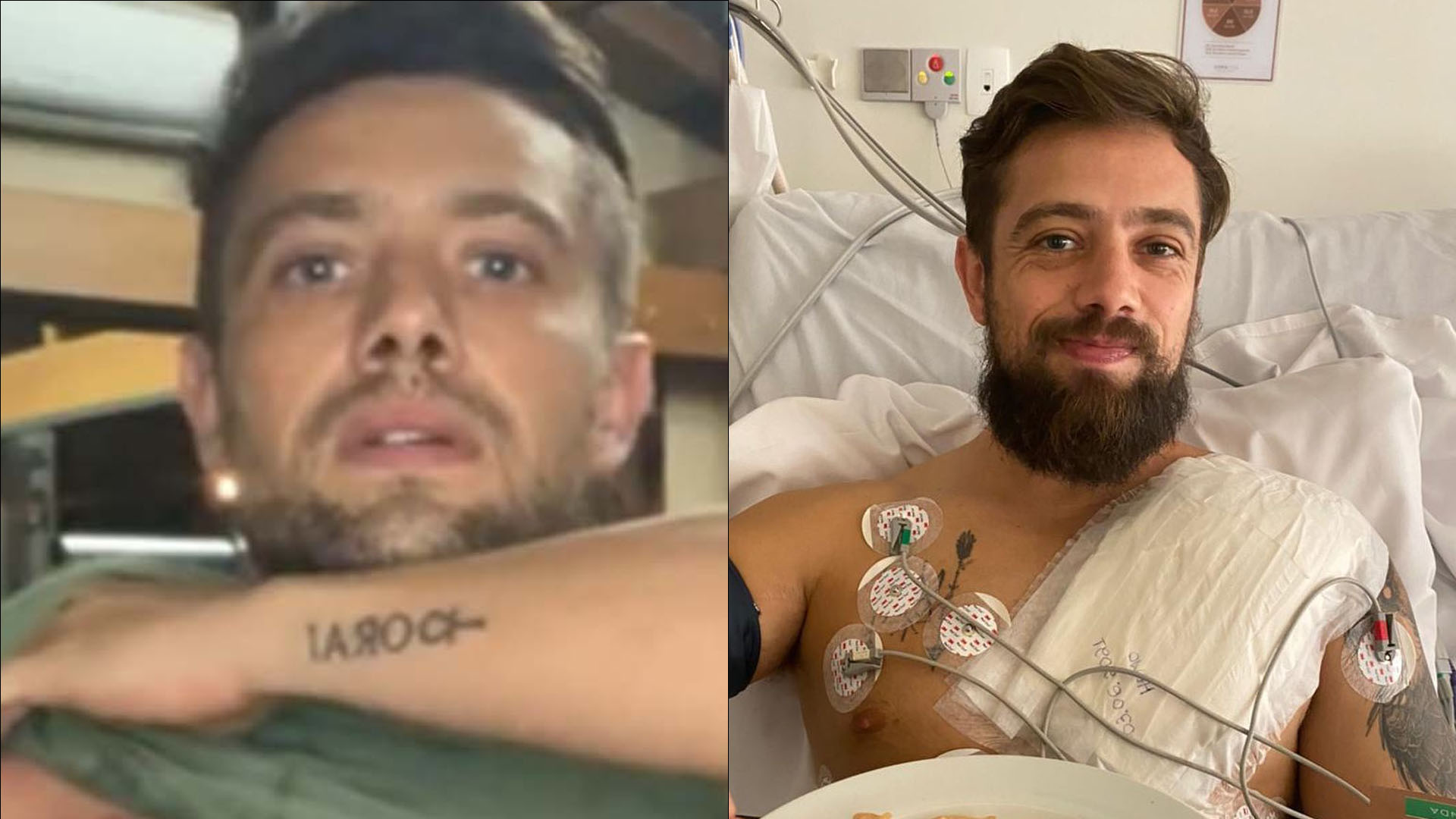 Rafael Cardoso mostra cicatriz no peito após cirurgia no coração: “A vida mudou”