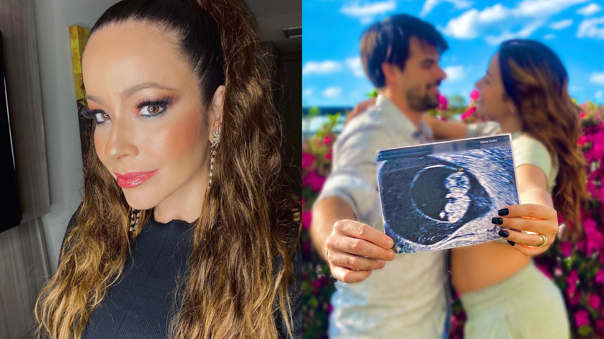 Aos 42 anos, Renata Domínguez revela que gravidez é um milagre: “A gente tinha 7% de chance”