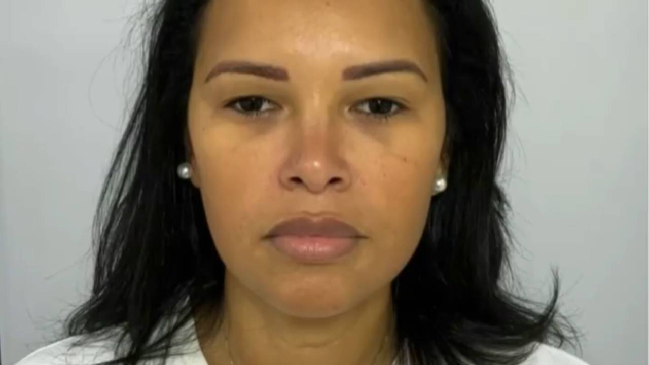 Ex-BBB Ariadna Arantes aposta em harmonização facial e mostra antes e depois surpreendente: “Gostaram?”