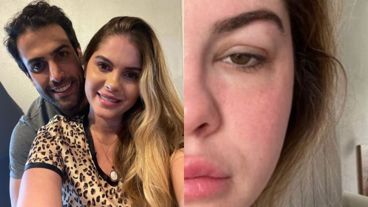 Em processo de fertilização in vitro, Bárbara Evans mostra rosto inchado devido ao uso de corticoide: “Demais”