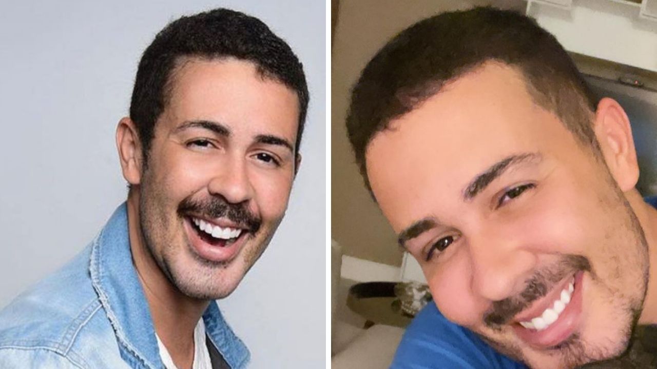 Carlinhos Maia revela como estão seus dentes após colocar lentes de contato: “Desgastei tanto, ficou igual um ratinho”