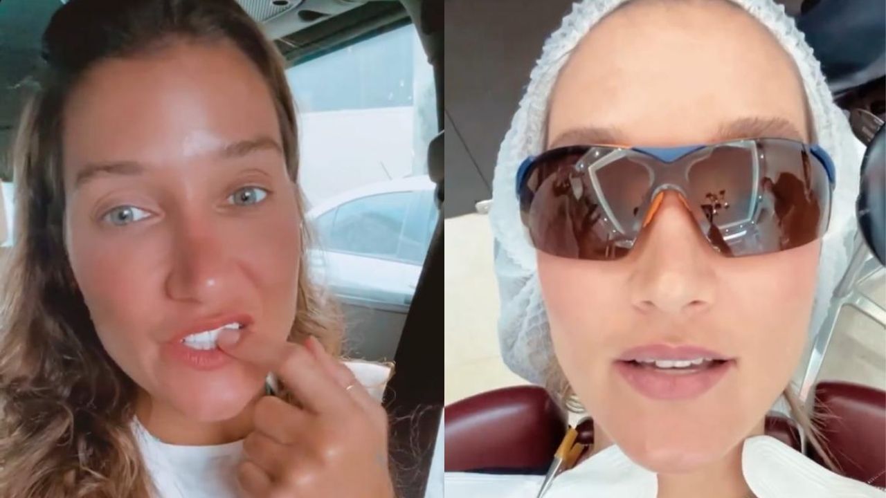 Como assim? Gabriela Pugliesi deixa dentes “imperfeitos” em procedimento estético: “Mais jovial”