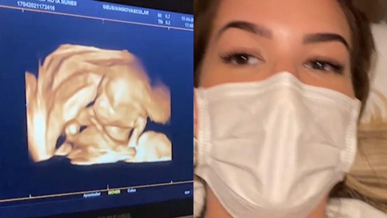 Lore Improta exibe novo ultrassom e flagra filha fazendo marca registrada do pai ainda na barriga: “Esperta”