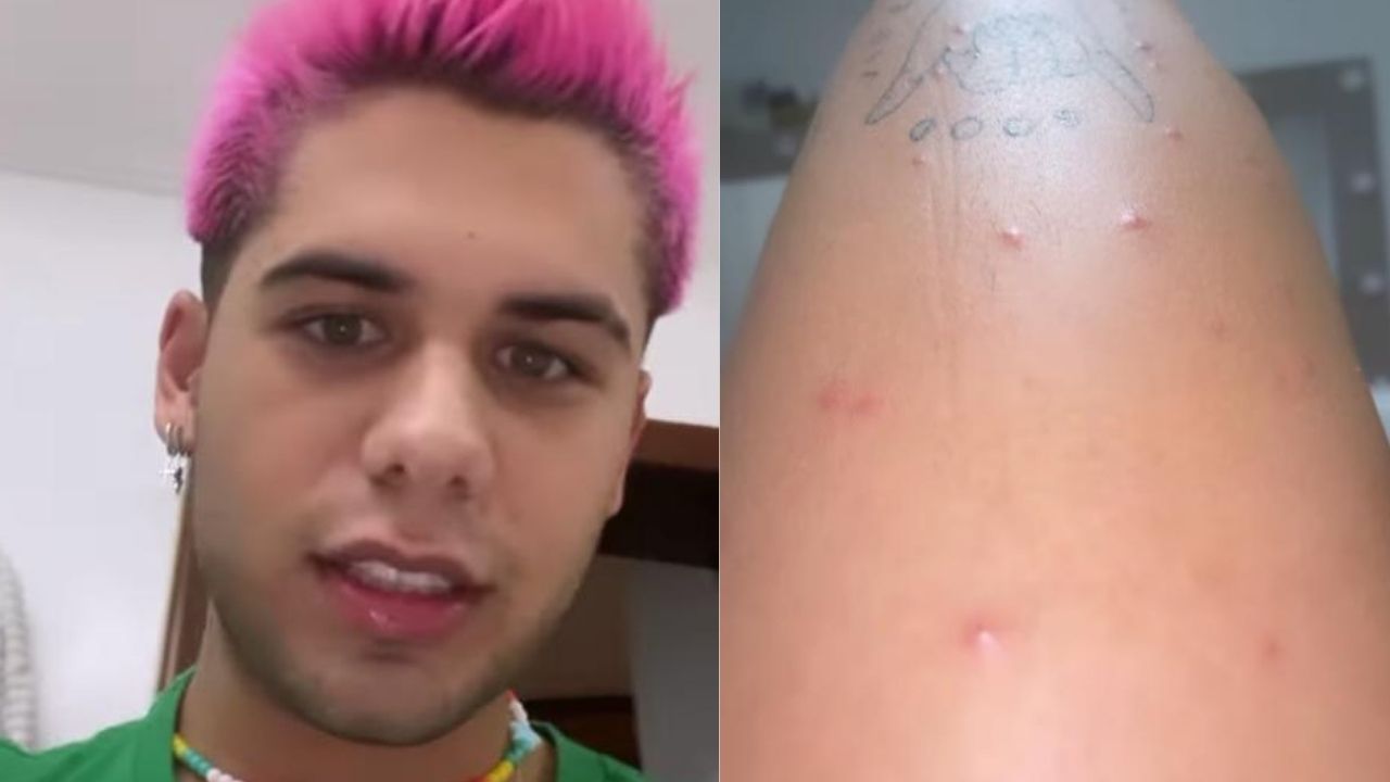 Após diagnóstico de doença, Zé Felipe atualiza quadro de saúde e exibe marcas pelo corpo: “Tomei quatro injeções”
