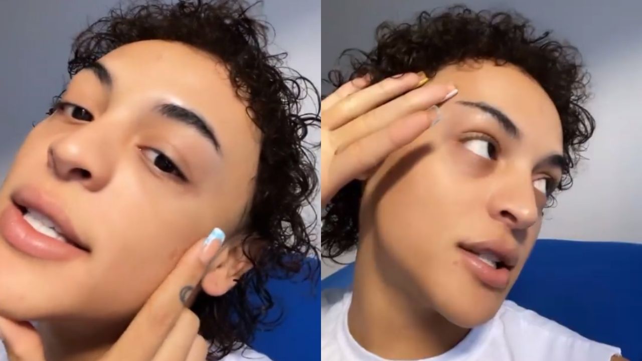 Pabllo Vittar se queixa de pele com acne e culpa país por espinhas: “Todo dia um estresse, não aguento mais”