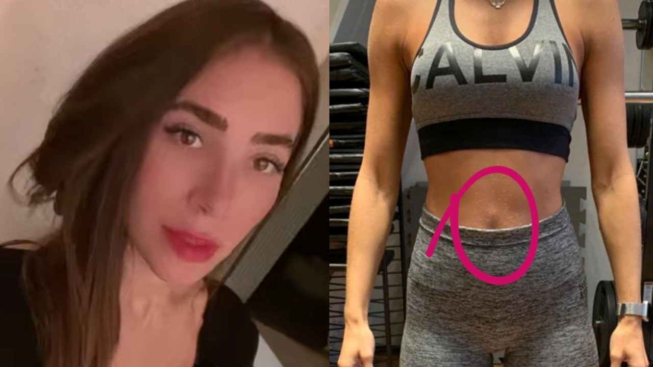 Após rumores de lipoaspiração, Romana Novais esclarece cirurgia na região abdominal: “Precisei corrigir”