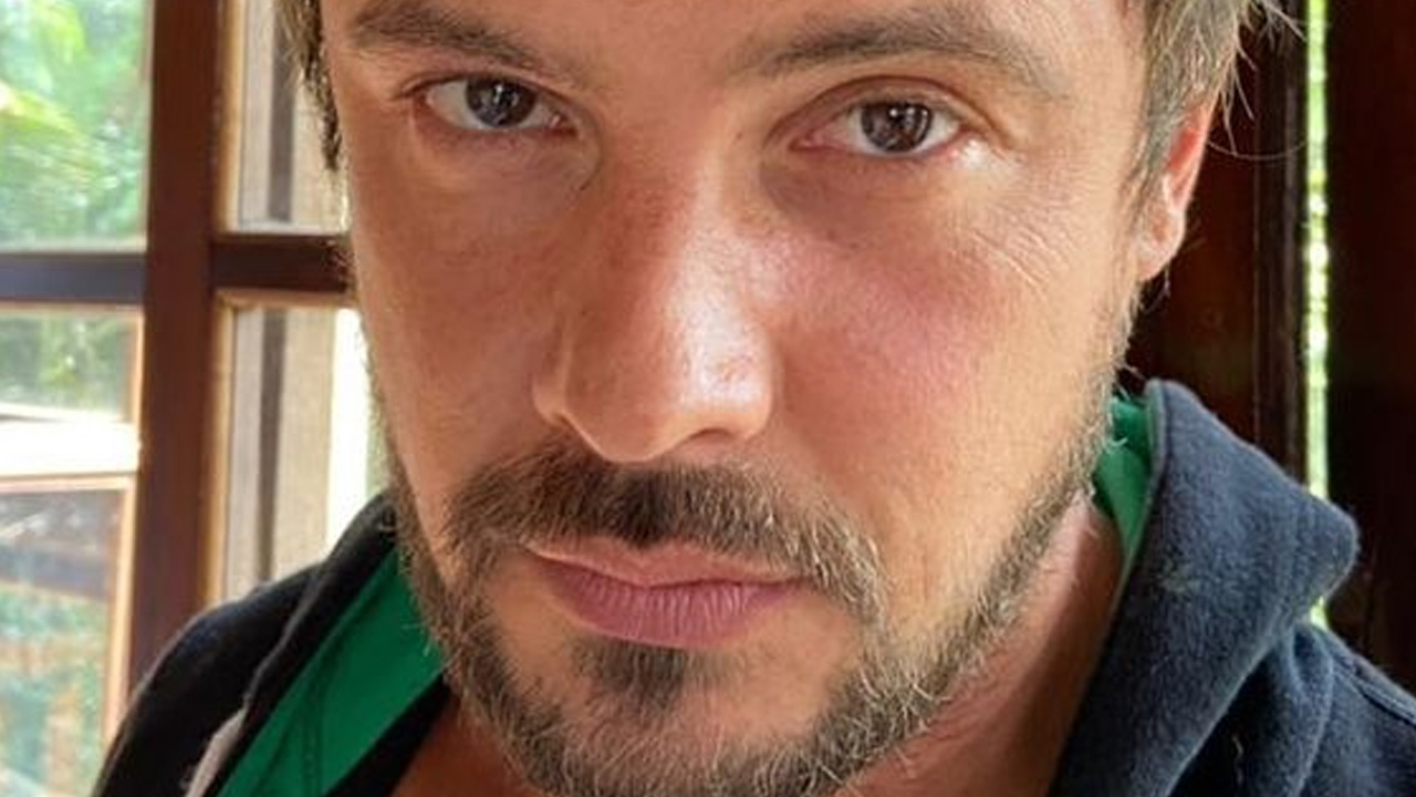 Sergio Guizé mostra resultado impressionante de transplante capilar e seguidores reagem: “Cabeleira”
