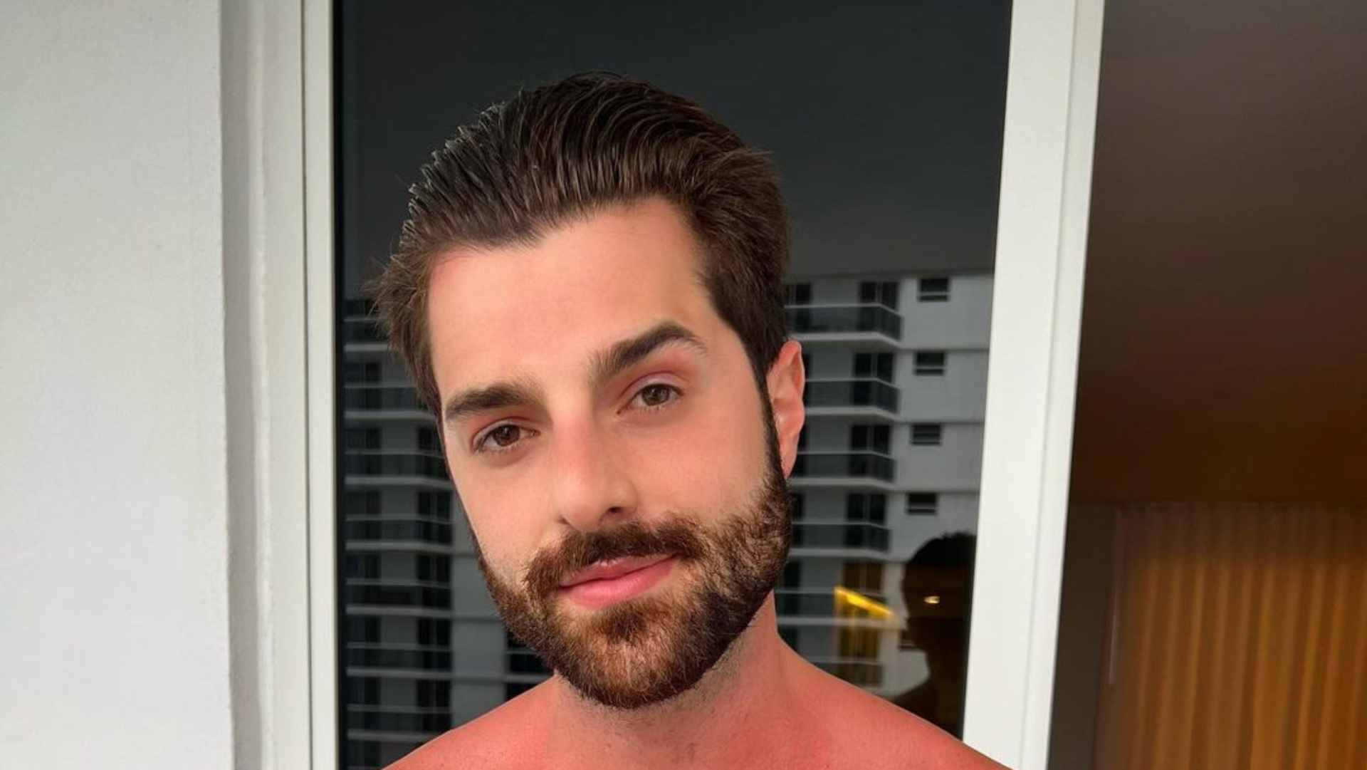 Deu ruim! Alok surge completamente queimado e desabafa: “Não aprendo nunca”