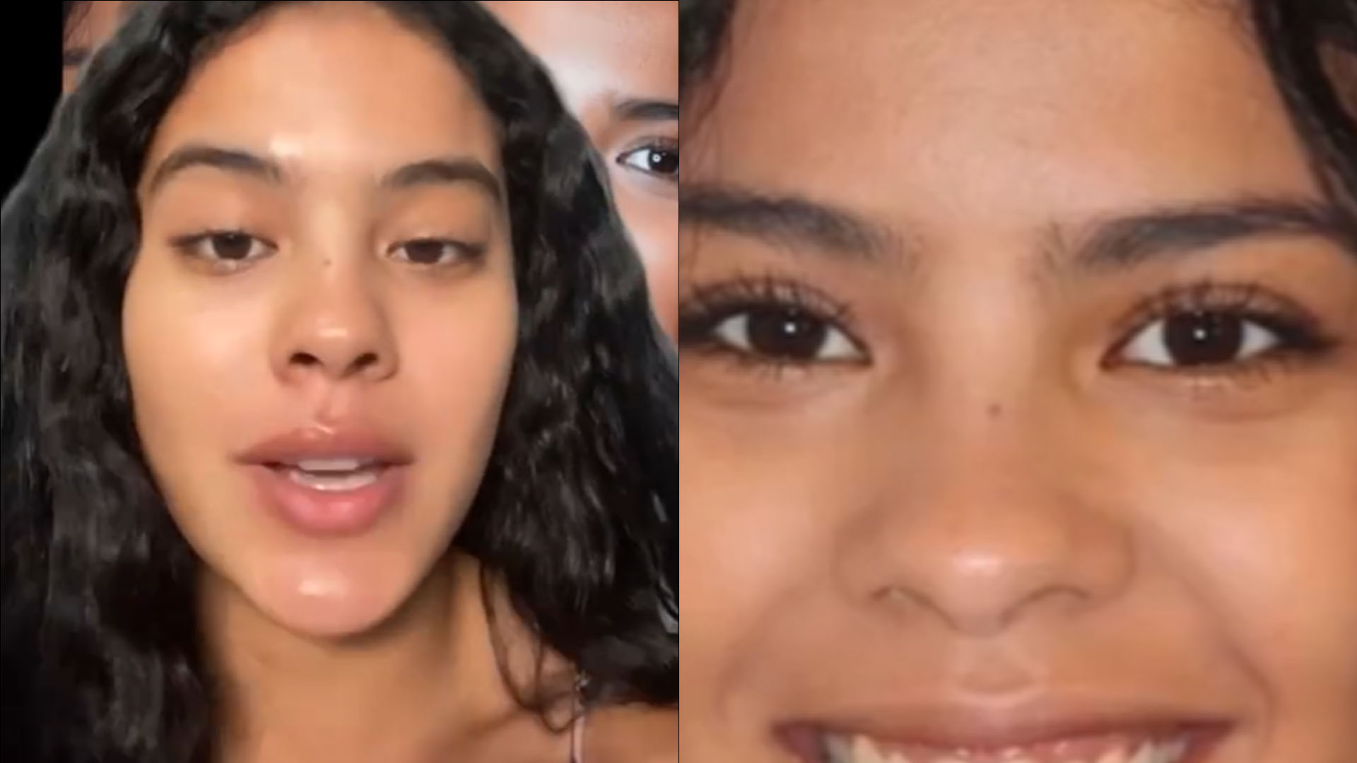 Muda de ‘Pantanal’, Bella Campos mostra resultado de plástica na gengiva: “Chocada”