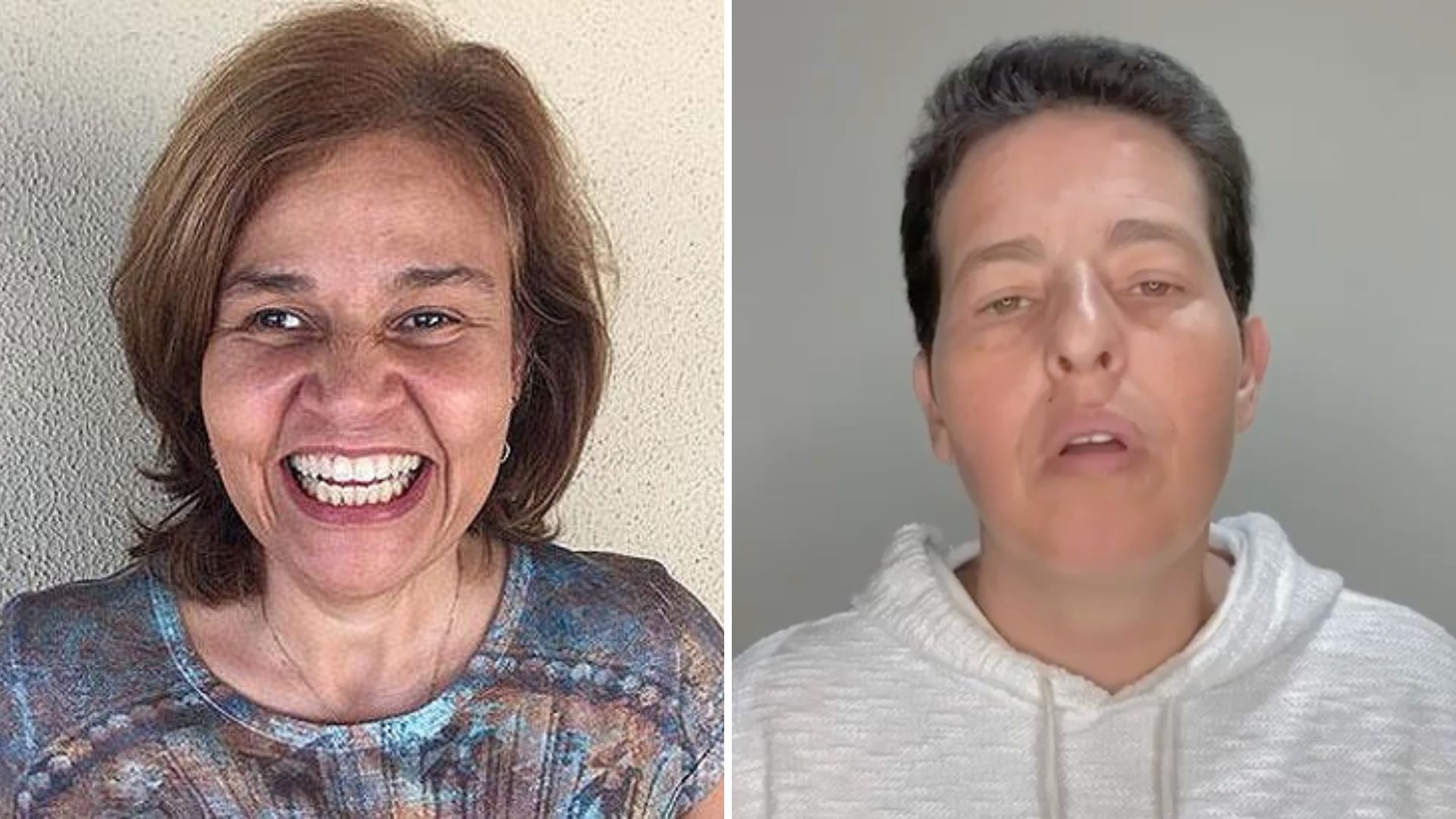 Claudia Rodrigues ‘ressuscita’ após declaração de Adriane Bonato: “Está outra pessoa”
