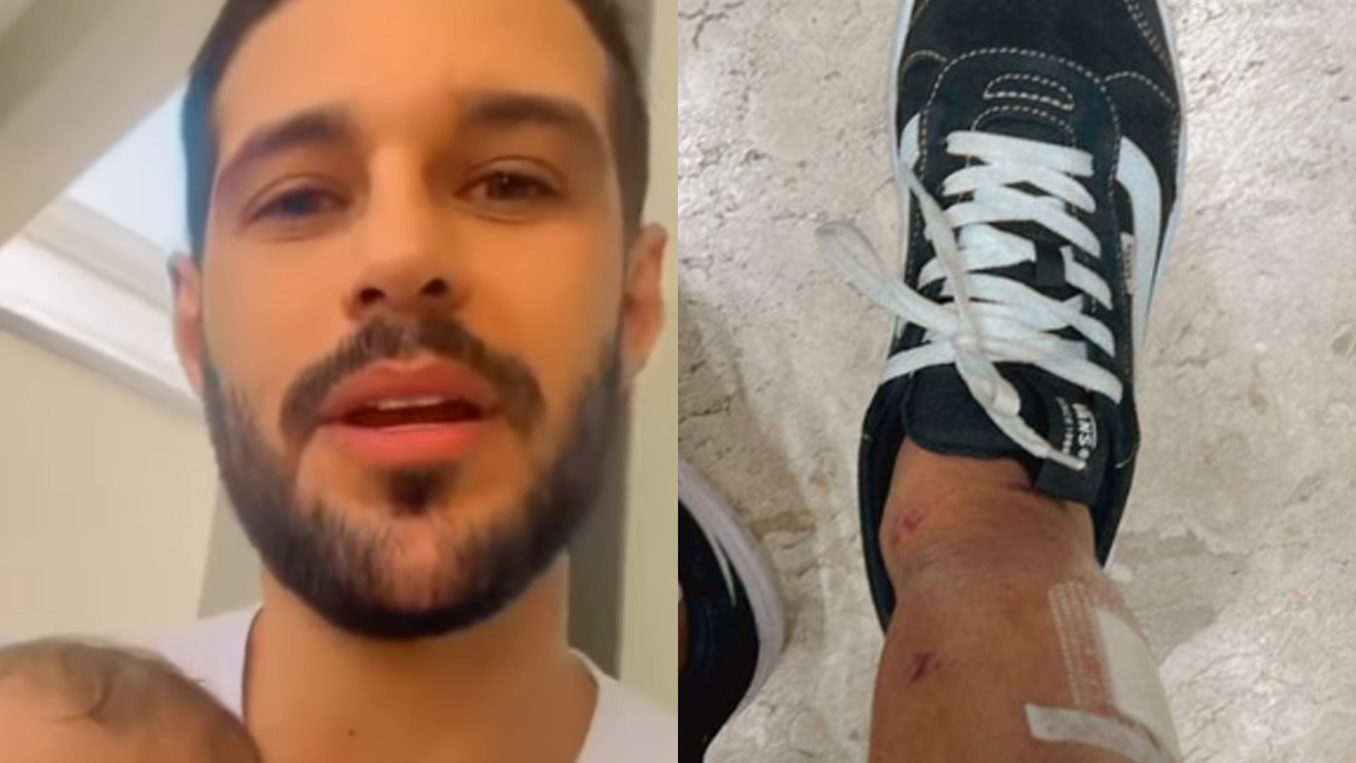 Ex-BBB Rodrigo Mussi mostra cicatrizes pela primeira vez: “Mais um dia”