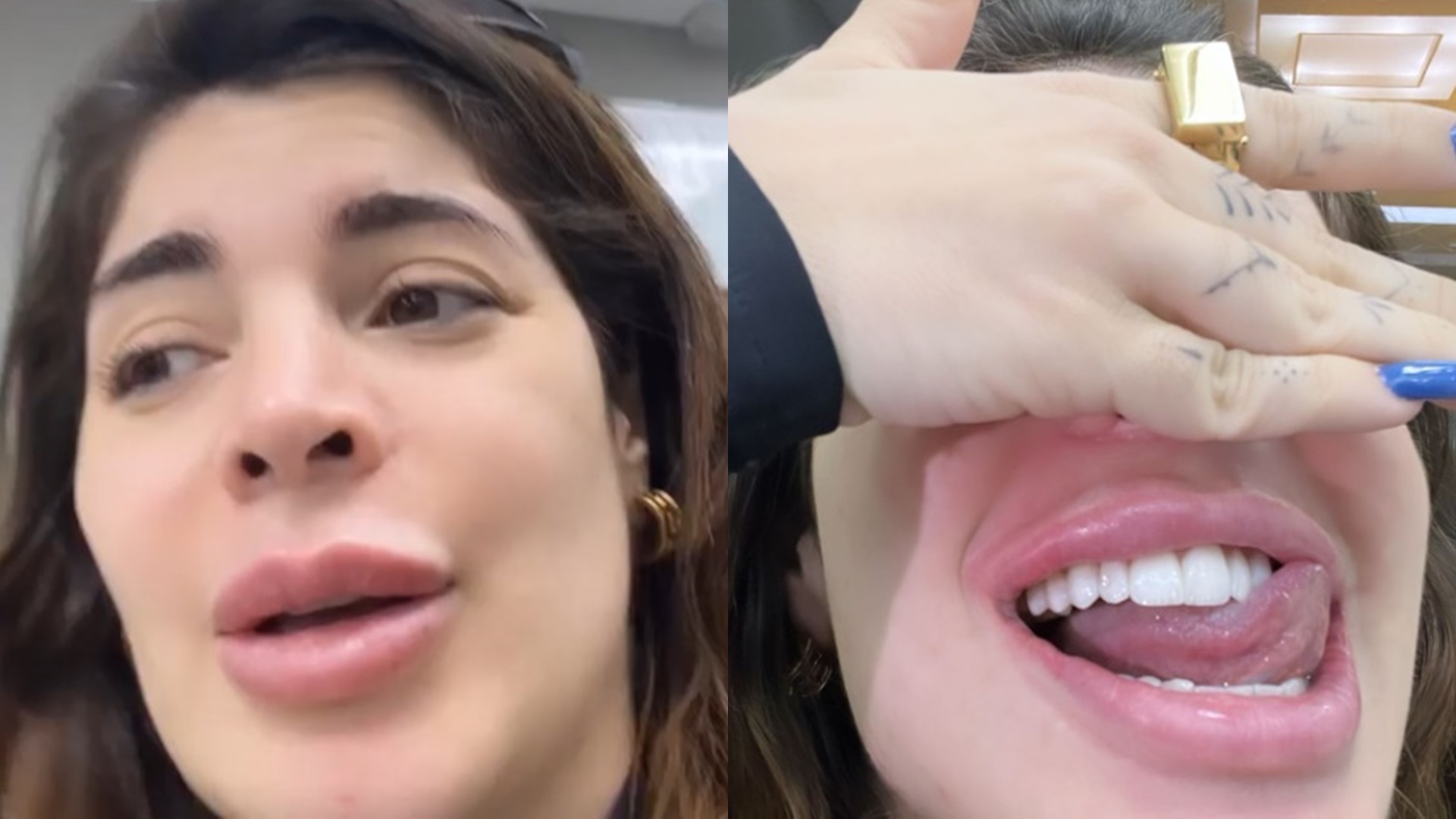 GKay ostenta fortuna e coloca diamante no dente: “Olha que perfeito”