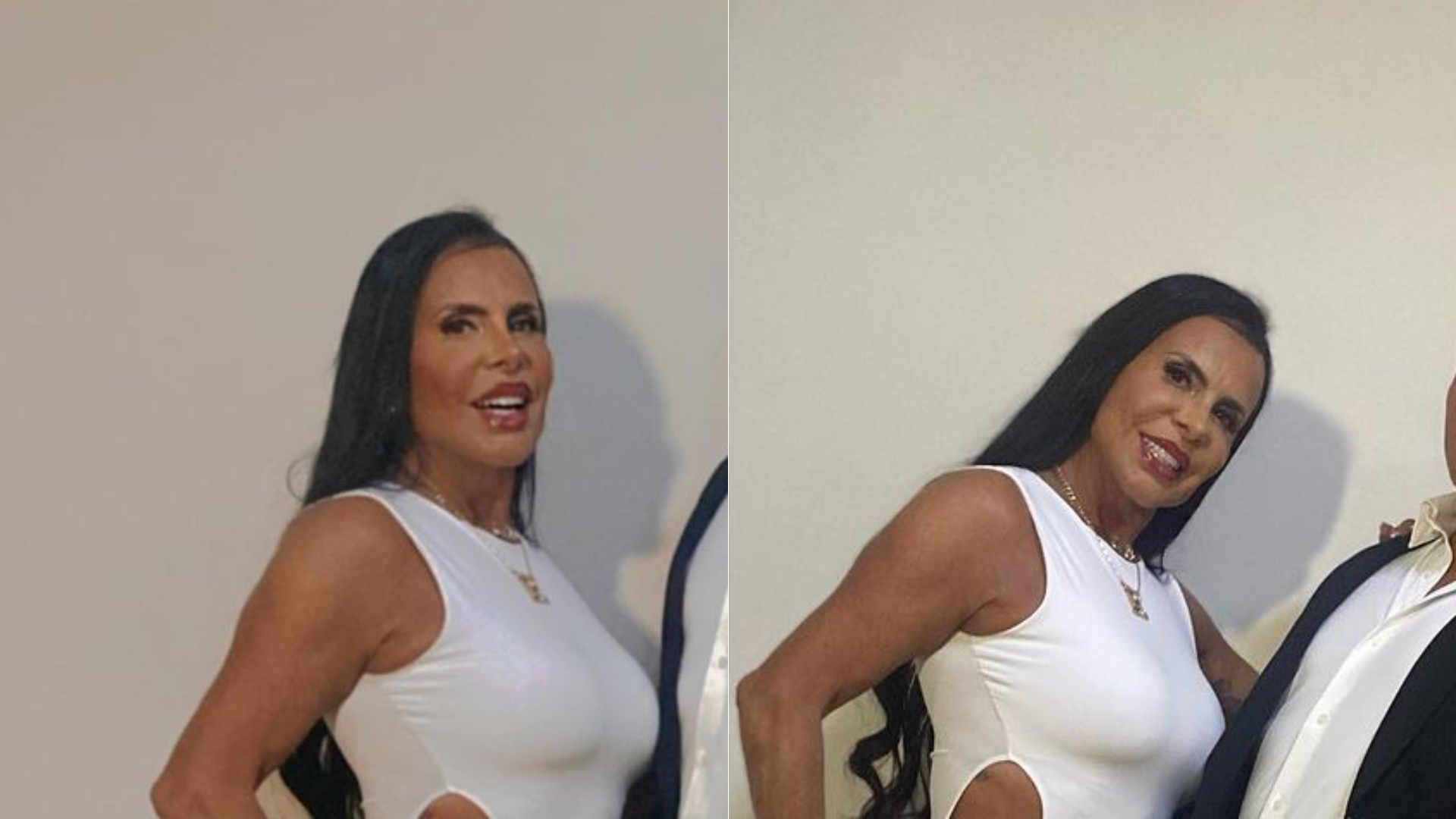 Gretchen dispensa calcinha e exibe detalhe íntimo com vestido recortado: “Um luxo”