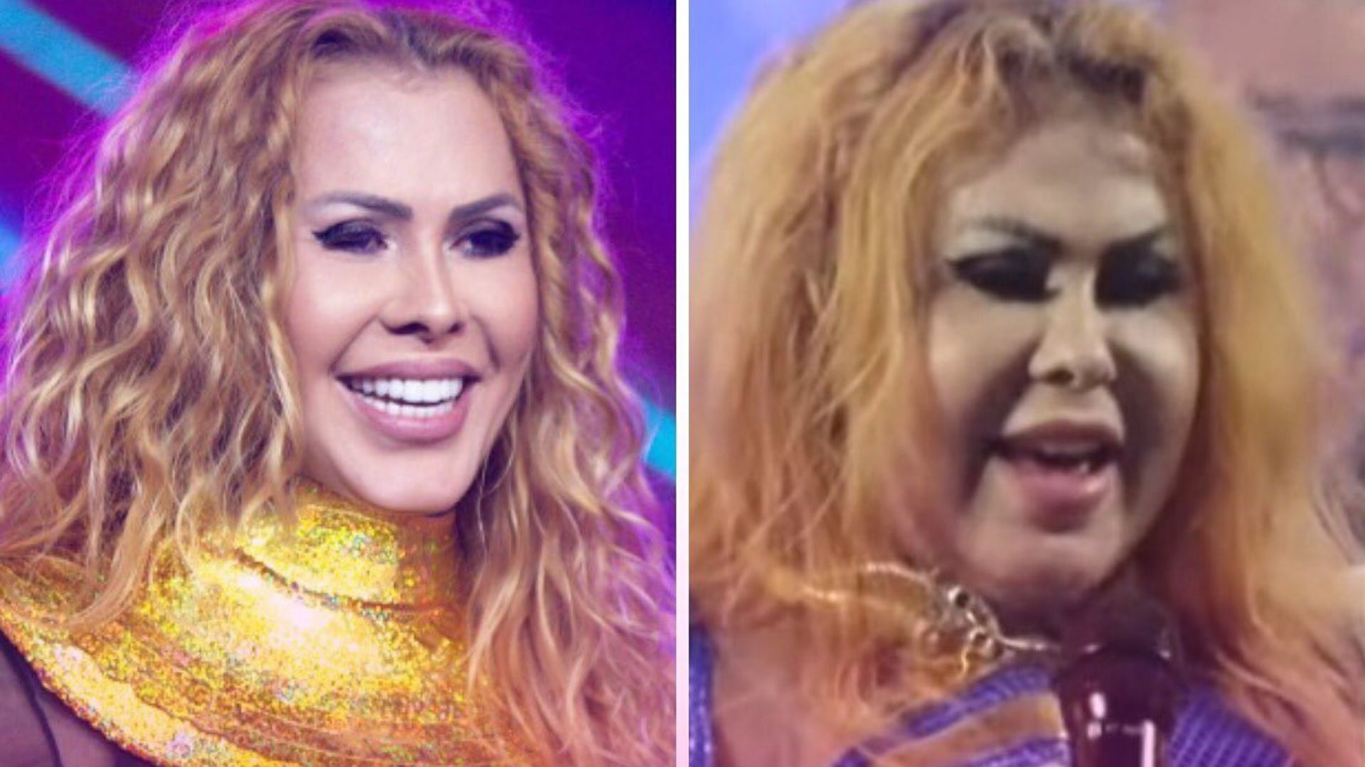 Joelma é internada e passa por exames após inchaço no rosto; médicos tem suspeita