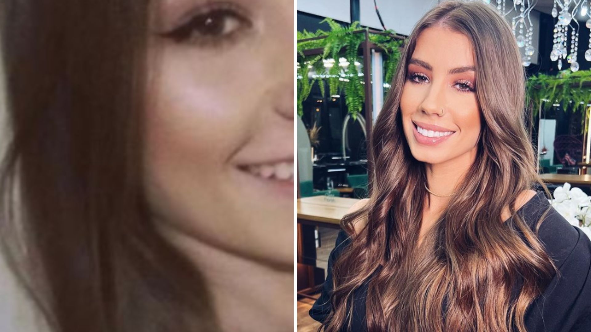 Ex de Whindersson Nunes mostra antes e depois de harmonização chocante: “Mais bonita”