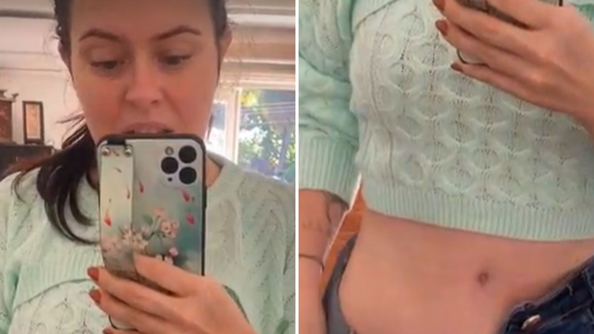 Mariana Bridi expõe cicatriz chocante após cirurgia delicada: “Fica inchado”