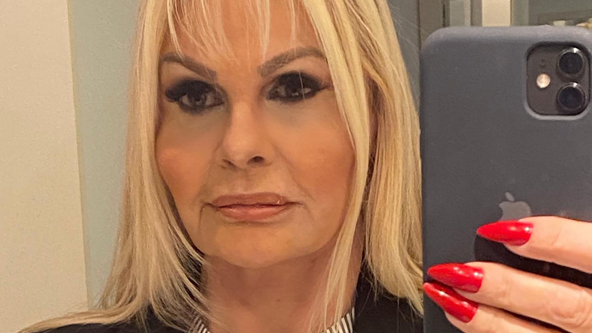Monique Evans vira piada com resultado de procedimento facial: “Não vi diferença”