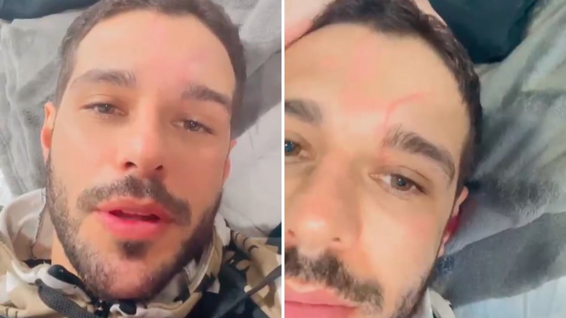 Rodrigo Mussi comove ao mostrar cicatriz após acidente: “Marca do milagre”