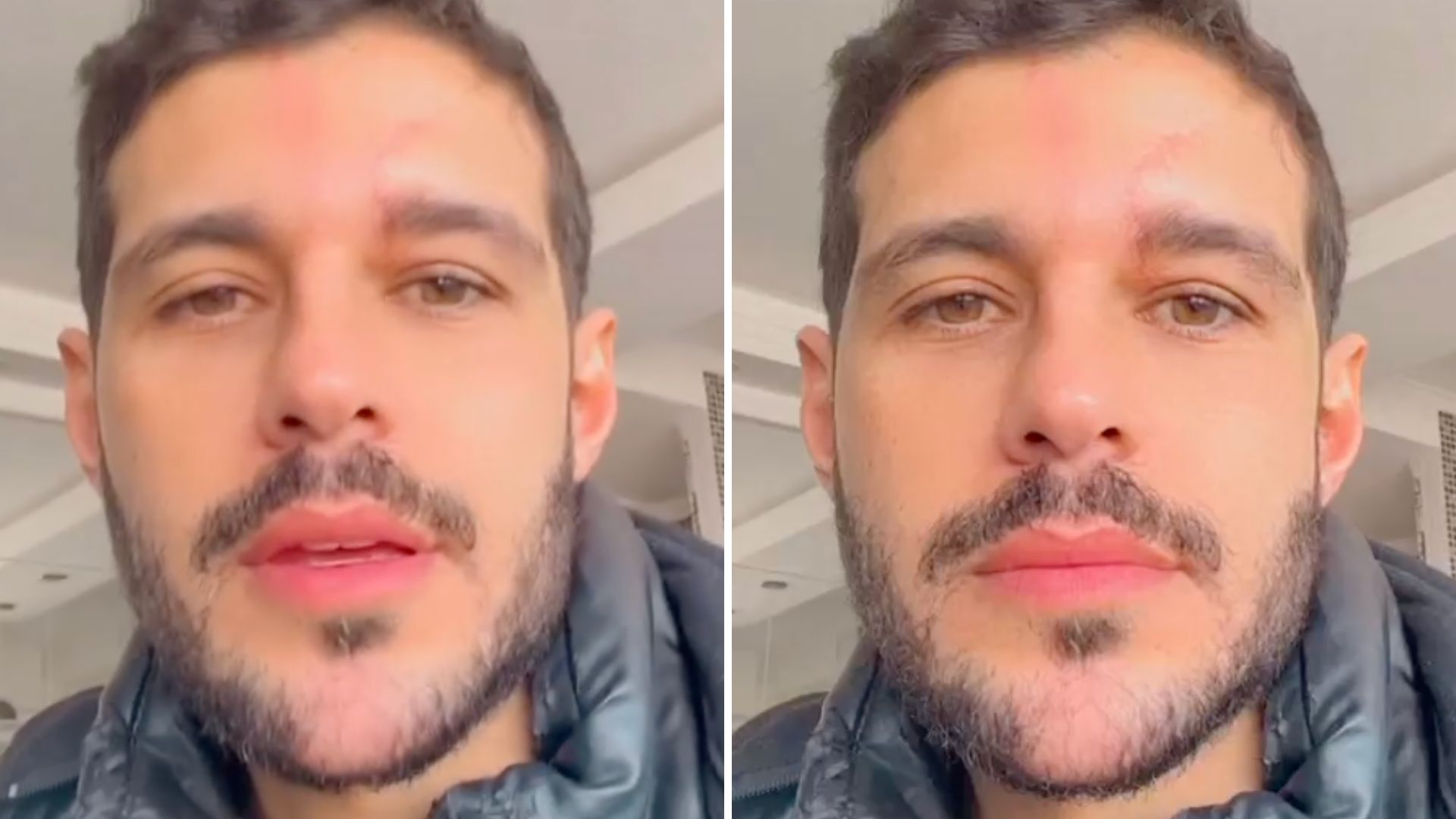 Retomando a vida, Rodrigo Mussi sofre recaída e fica de cama após festa: “Muito doente”