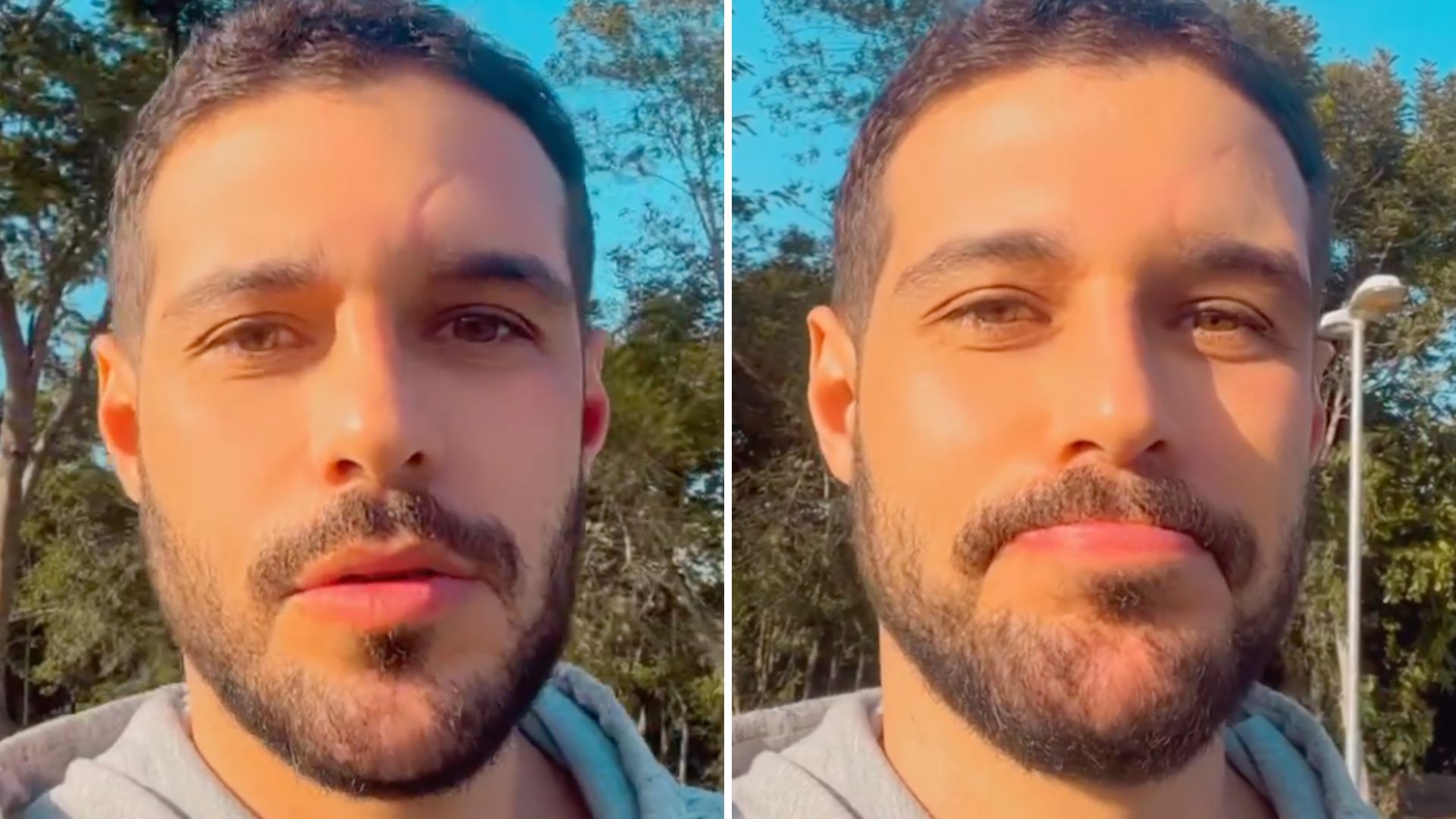 Ex-BBB Rodrigo Mussi revela sequelas de acidente grave: “Não estou sentindo”