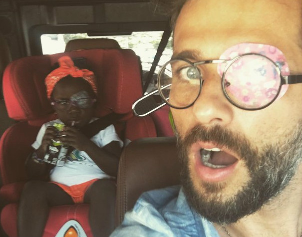 Que fofura! Bruno Gagliasso usa tampão no olho igual ao da filha Titi