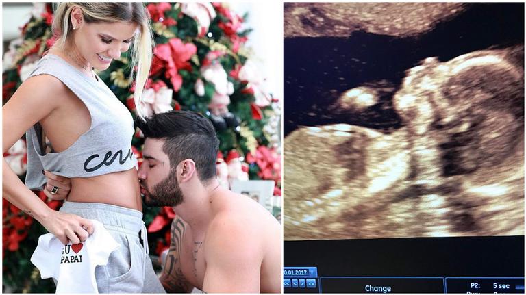 Andressa Suíta mostra ultrassom do primeiro filho: “Meu melhor presente”