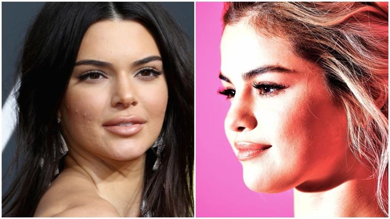 Você assumiria suas espinhas como fez Kendall Jenner?
