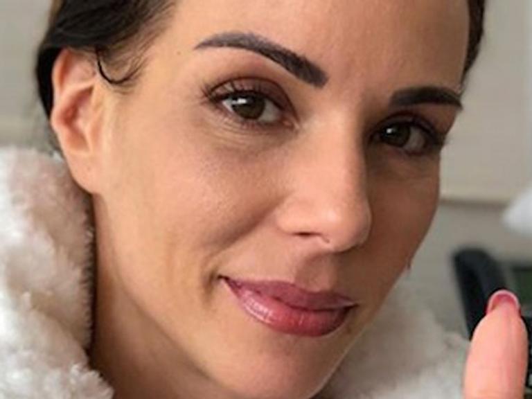 Ana Furtado relata procedimento para impedir queda de cabelo durante a quimioterapia: ‘Doloroso’