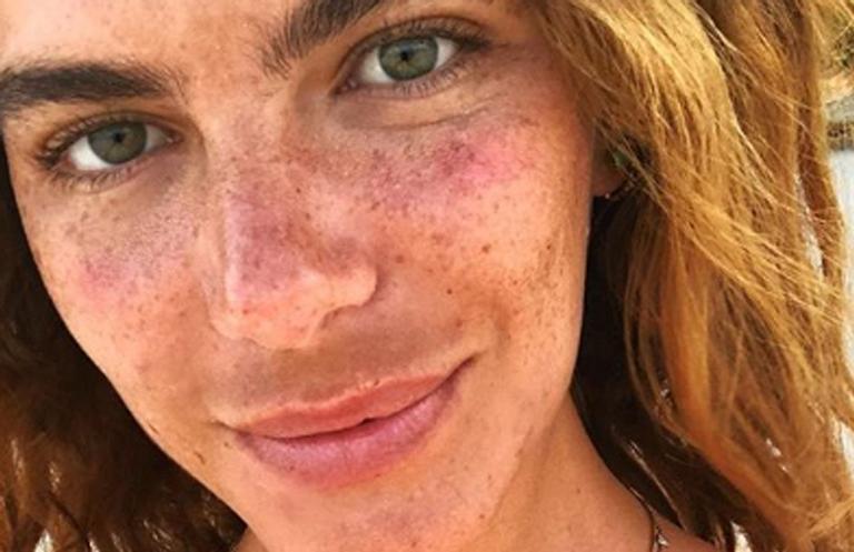 Mariana Goldfarb posa com zero retoques e exibe sardas: ”Não peço que me aceites”