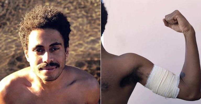 Ícaro Silva relata em detalhes desespero ao se ver no meio de um tiroteio: ”Uma bala rasgou meu braço”