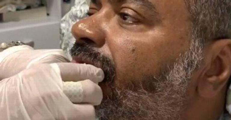Arlindo Cruz reaparece fazendo exercícios para reaprender a mastigar