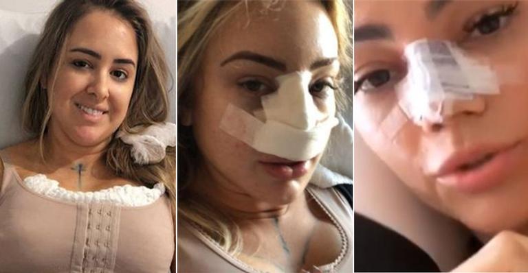 Tira gordura! Põe Silicone! Afina o nariz! Relembre as celebridades que fizeram plástica em 2018