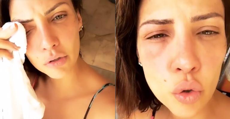 Camila Rodrigues vive momentos de pânico após problema nos rins: ”Vontade enorme de chorar”