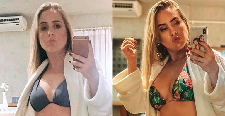 Patrícia Leitte mostra antes e depois em foto de biquíni: ”O importante é estar feliz”