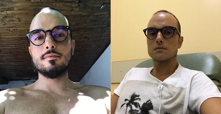 Ator pede ajuda e faz vaquinha para o tratamento contra o câncer