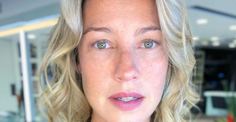 Luana Piovani mostra os peitos na redes sociais e marca cirurgião plástico: ”Martelinho de ouro”
