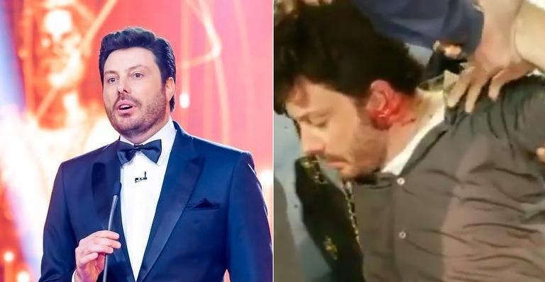 Danilo Gentili é agredido e sai de entrevista sangrando: ”Péssima noite”